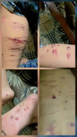 Pengamen Cilik Diduga Jadi Korban Penyiksaan Oknum, IPWL Rumah Asa Silampari